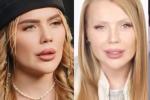 Косметолог Мухина уличила Карину Кросс во лжи относительно филлеров в лице
