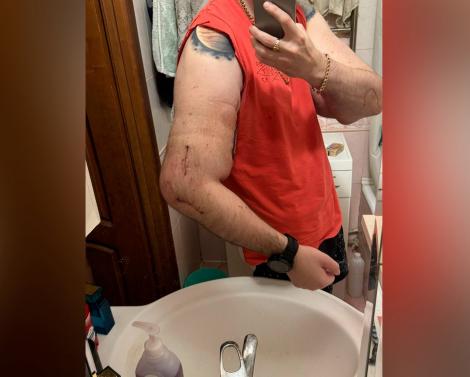 «Сократил жизнь лет на 20»: блогера Руки-Базуки могут ждать деменция или аутоиммунное заболевание «Сократил жизнь лет на 20»: блогера Руки-Базуки могут ждать деменция или аутоиммунное заболевание