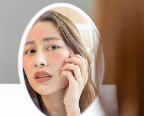 Косметолог предупредила о рисках для кожи в отопительный сезон