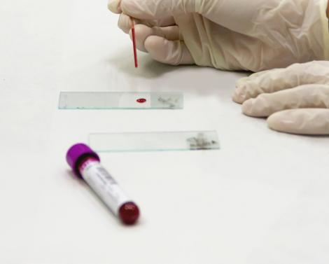 Тест ImmunoHealth: анализ на 111 продуктов Москва Тверь Тест ImmunoHealth: анализ на 111 продуктов Москва Тверь