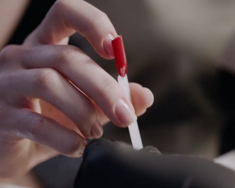 Самый частый дефицит, приводящий к ломкости и расслоению ногтей.