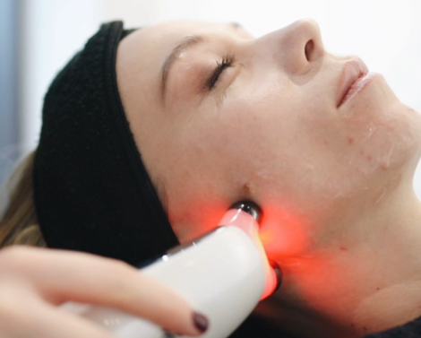 Микротоки для лица