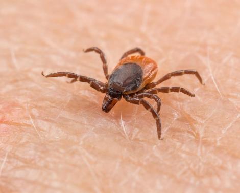 Страдающие бессонницей клещи могут вызвать инфекционный шок