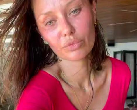 Почему лица звёзд иногда выглядят измождёнными?